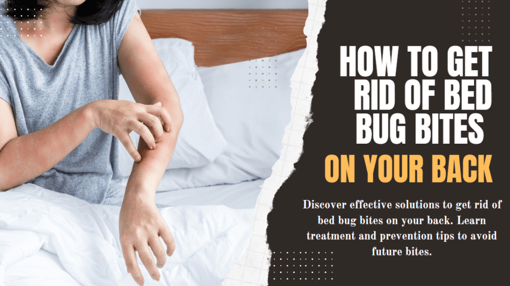 How to Get Rid of Bed Bug Bites on Your Back