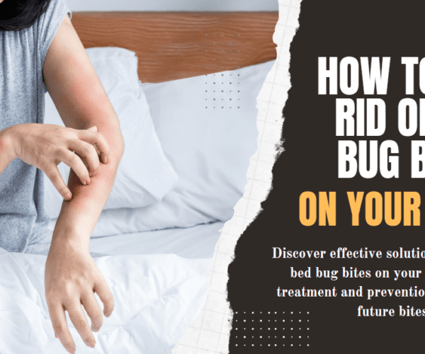 How to Get Rid of Bed Bug Bites on Your Back